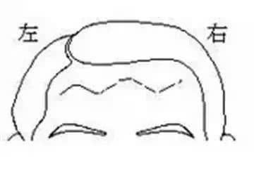 看额头皱纹命运图解,额头有皱纹代表命苦吗