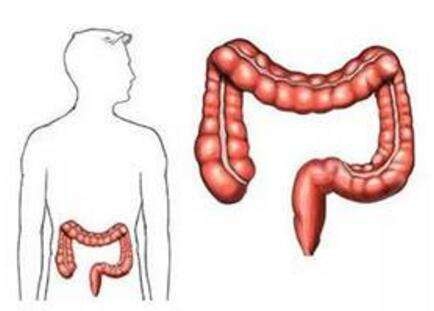 为什么会得直肠癌呢,为什么肠癌大部分都是直肠癌