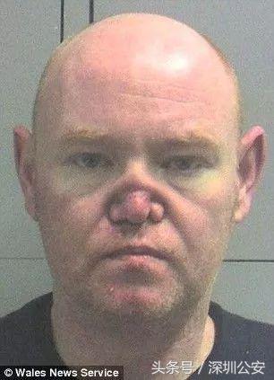 禁毒减肥法图片大全,禁毒减肥法图片