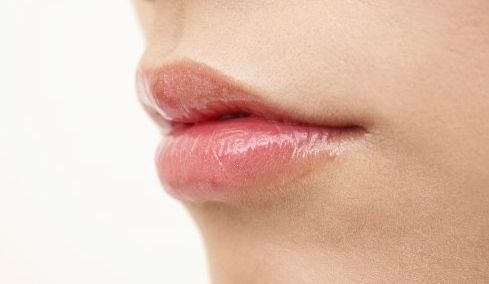 莫匹罗星软膏可以治疗嘴角起泡吗,孩子经常嘴角烂嘴角起泡怎么办