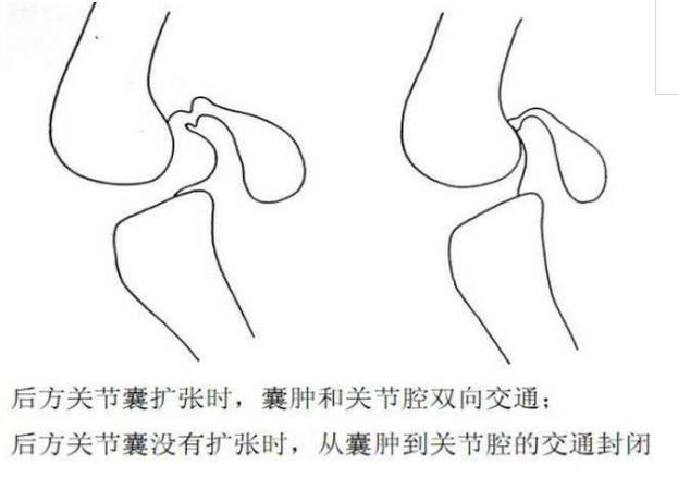 常见的十大膝关节疼痛,老年患者膝关节疾病健康科普
