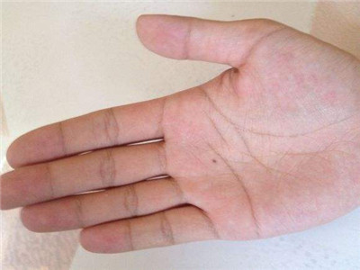 女人10处有痣是富贵痣举例,女人这几处有痣是富贵痣