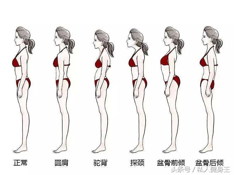 长期久坐骨盆前倾最快矫正法,如何改善久坐骨盆前倾