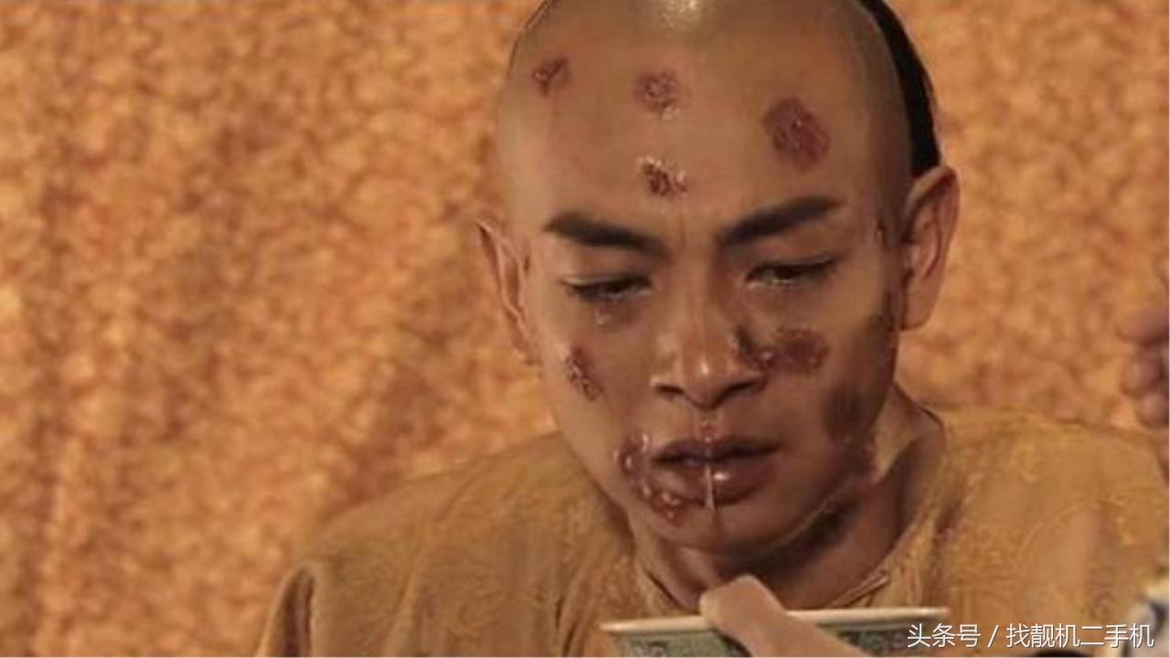 古代天花难治吗,古代天花大爆发