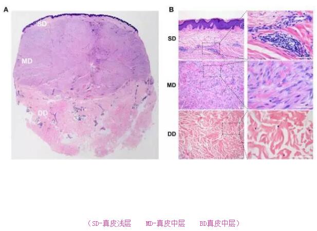 全国治疗瘢痕疙瘩的最好的医院,瘢痕疙瘩注射治疗一针大概多少钱