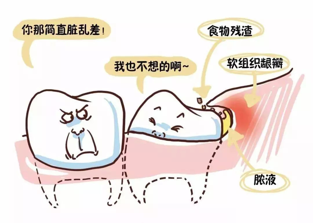 智齿作为人体最大漏洞之一，该如何对待