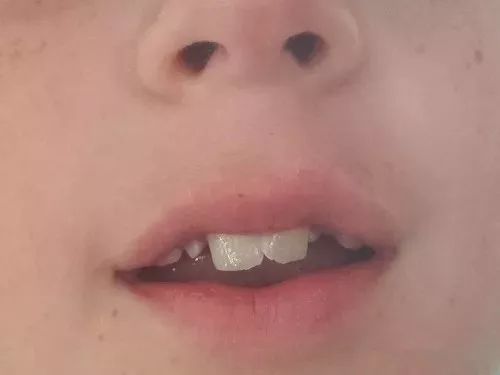 孩子b和d不分怎么办,孩子b和d读音不对