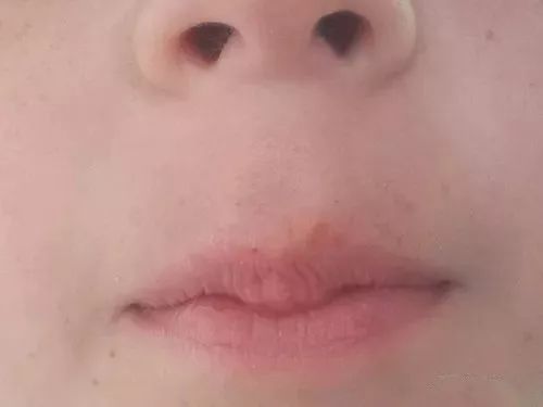 孩子b和d不分怎么办,孩子b和d读音不对