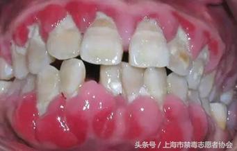 毒言毒语大全,一口烂牙你们郁闷吗