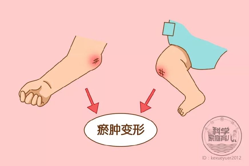 宝宝后脑勺摔了怎么判断有没有事,宝宝后脑勺着地摔了会影响小脑吗