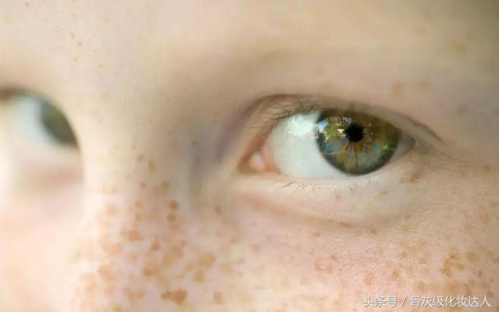 长了斑点怎么去除,长色斑怎么办5大方法祛除色斑