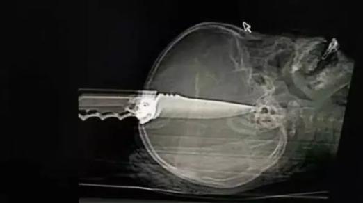 过量吸食毒品最终会导致什么,吸食毒粉会给人带来哪些影响