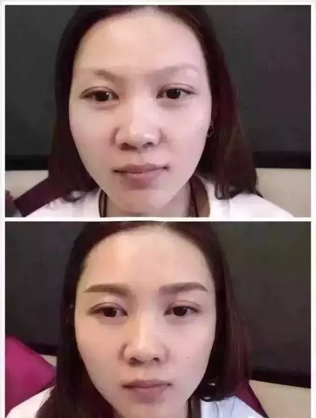 眉毛多有没有必要做眉毛,眉毛做不好看了还能改吗