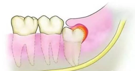 牙疼不是病痛起来要人命图片,牙疼不是病疼得要人命