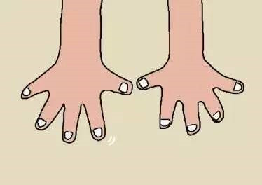 潮湿灰指甲,闷热潮湿引起的真菌感染