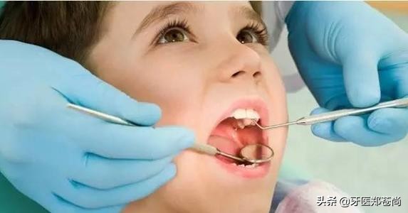 4岁小孩有蛀牙怎么办需要补吗,4岁半儿童有蛀牙需要修补嘛