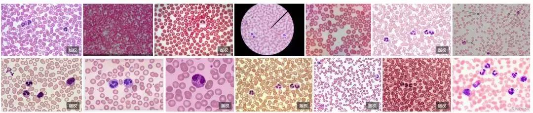 哺乳期可以喝酵素清肠吗,哺乳期可以喝减肥酵素果冻吗