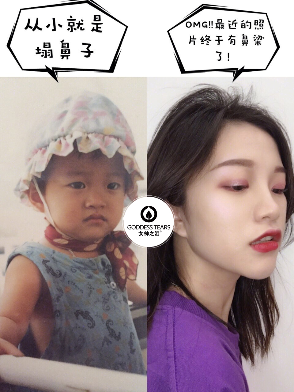 韩国整容瘦身法,韩国徒手瘦鼻方法