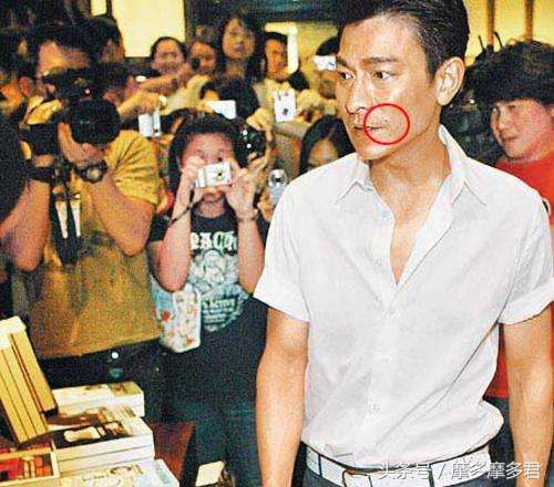 身体上的哪些痣代表富贵,一个人最富的三种痣