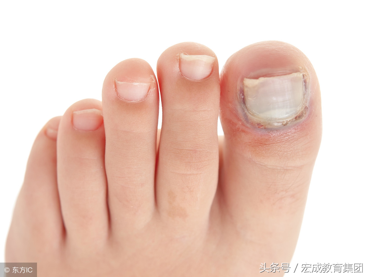 局限性神经功能障碍性皮肤病用药,常见的皮肤病用什么草药治疗