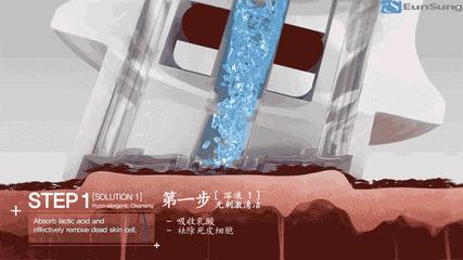 什么是小气泡项目,什么是小气泡