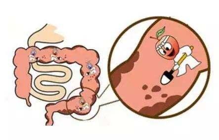 便秘会导致肠道有什么影响,便秘危害大5碗对症食疗轻松通便