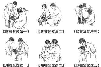 何为中医正骨,什么是正骨教学视频