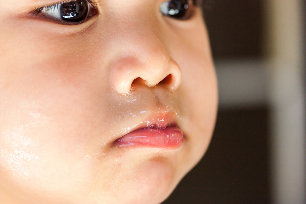 感冒流清鼻涕需要吃抗生素吗,黄鼻涕吃什么抗生素