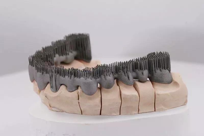 两三百块的烤瓷牙怎样,3000块的烤瓷牙