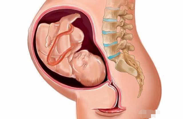 胎儿入盆了孕妈会有什么感觉,胎儿入盆孕妈会有什么感觉
