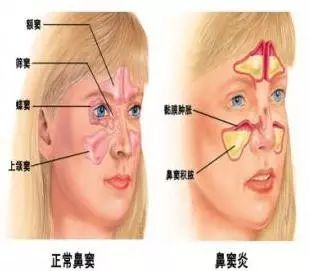 儿童口腔不良习惯的危害和防治,小孩嘴巴臭臭的是消化不良吗