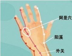 老中医治腰椎间盘突出立刻见效,火灸对腰椎间盘突出有效吗