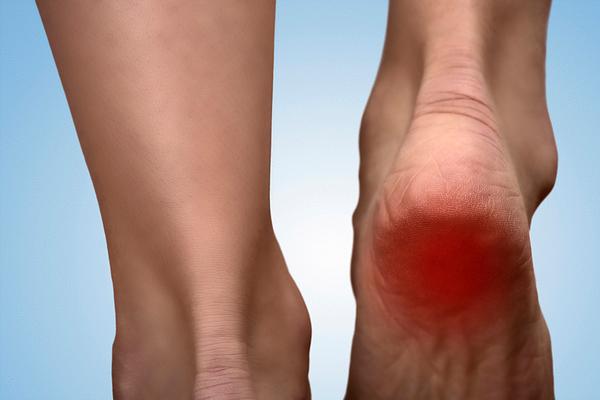 脚一踩地就疼怎么缓解,早上醒来脚踩地疼走一会儿就好了