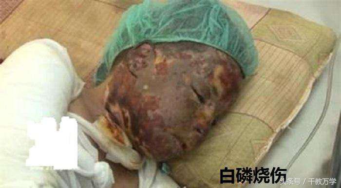 初中化学红磷和白磷的区别,初中化学红磷和白磷的存放