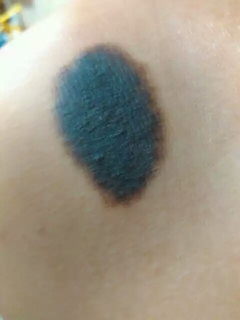 点痦子祛痣要格外注意安全,点痦子点坏了