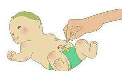 宝宝脐疝要怎么处理,儿子8岁了脐疝要动手术么