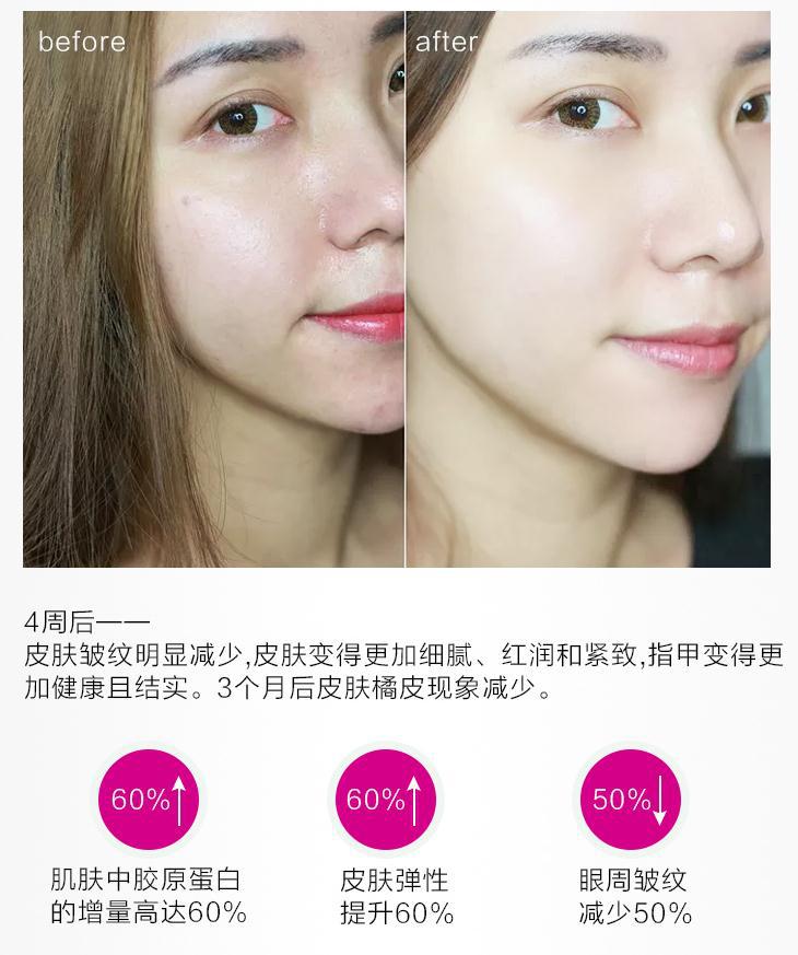 德国的胶原蛋白口服液,德国胶原蛋白玻尿酸口服液