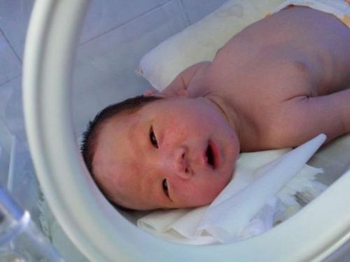 宝宝一出生头上就长这种瘤，如何识别良性OR恶性？新妈妈快来看看