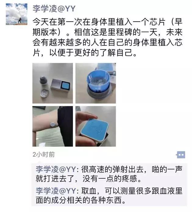 体内植入式芯片,人体芯片的真实现状有什么优势