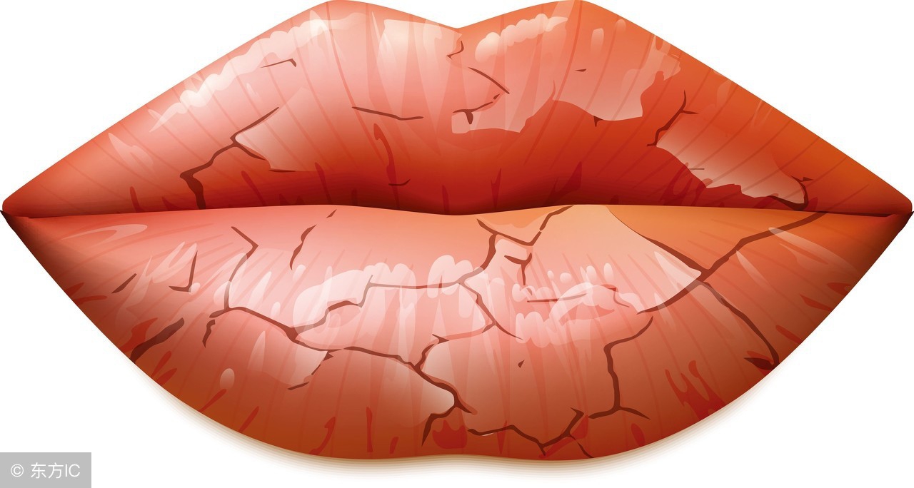 冬天嘴唇干燥怎么办用什么维生素,冬天皮肤干燥嘴唇干裂吃什么好