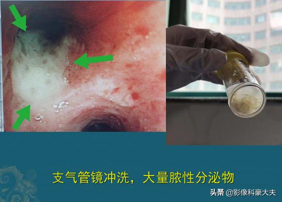 陪理科高材生的女同学看病，真麻烦，豪大夫想拉黑她