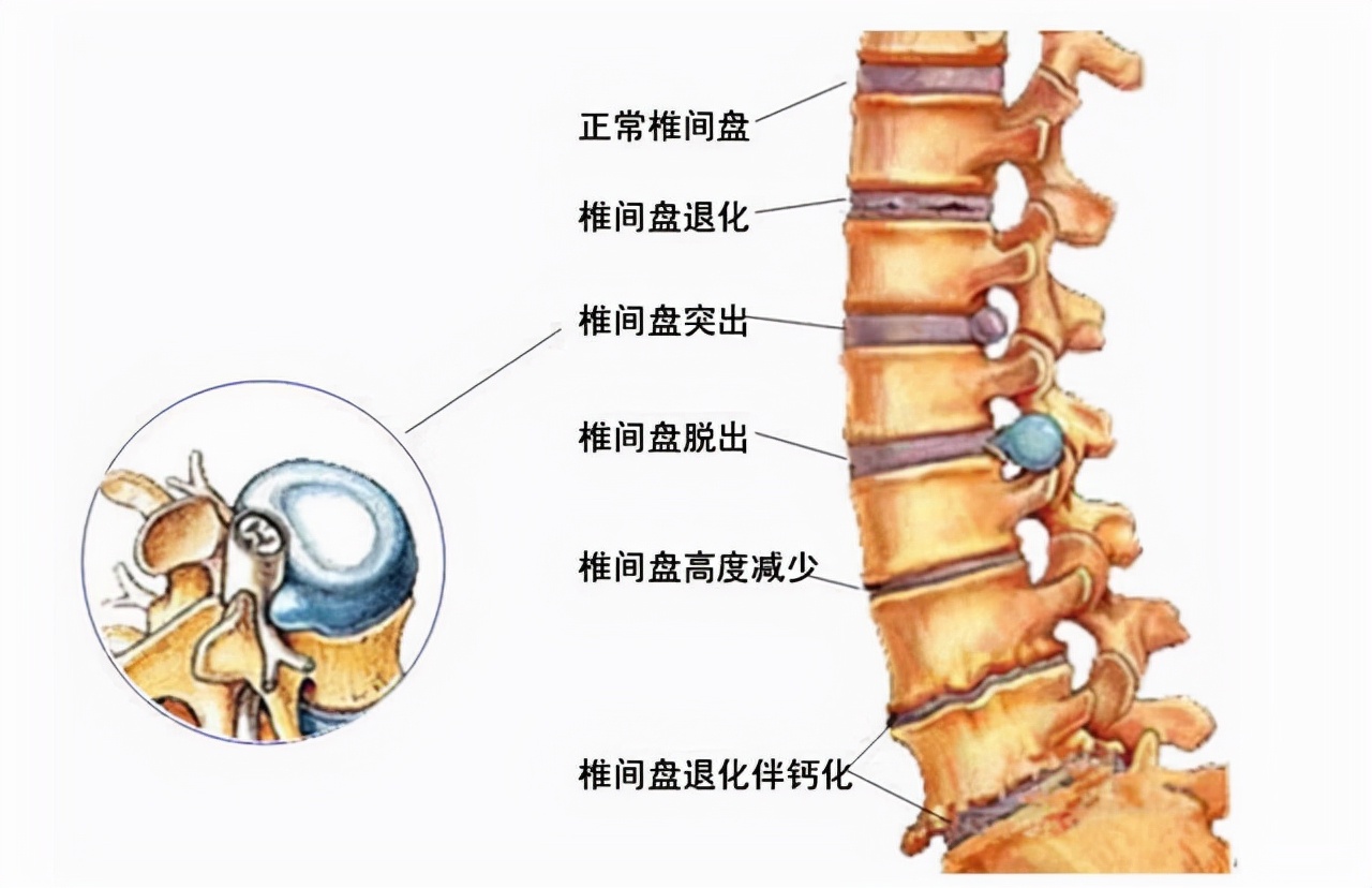 无效治疗是什么病,无效的治疗