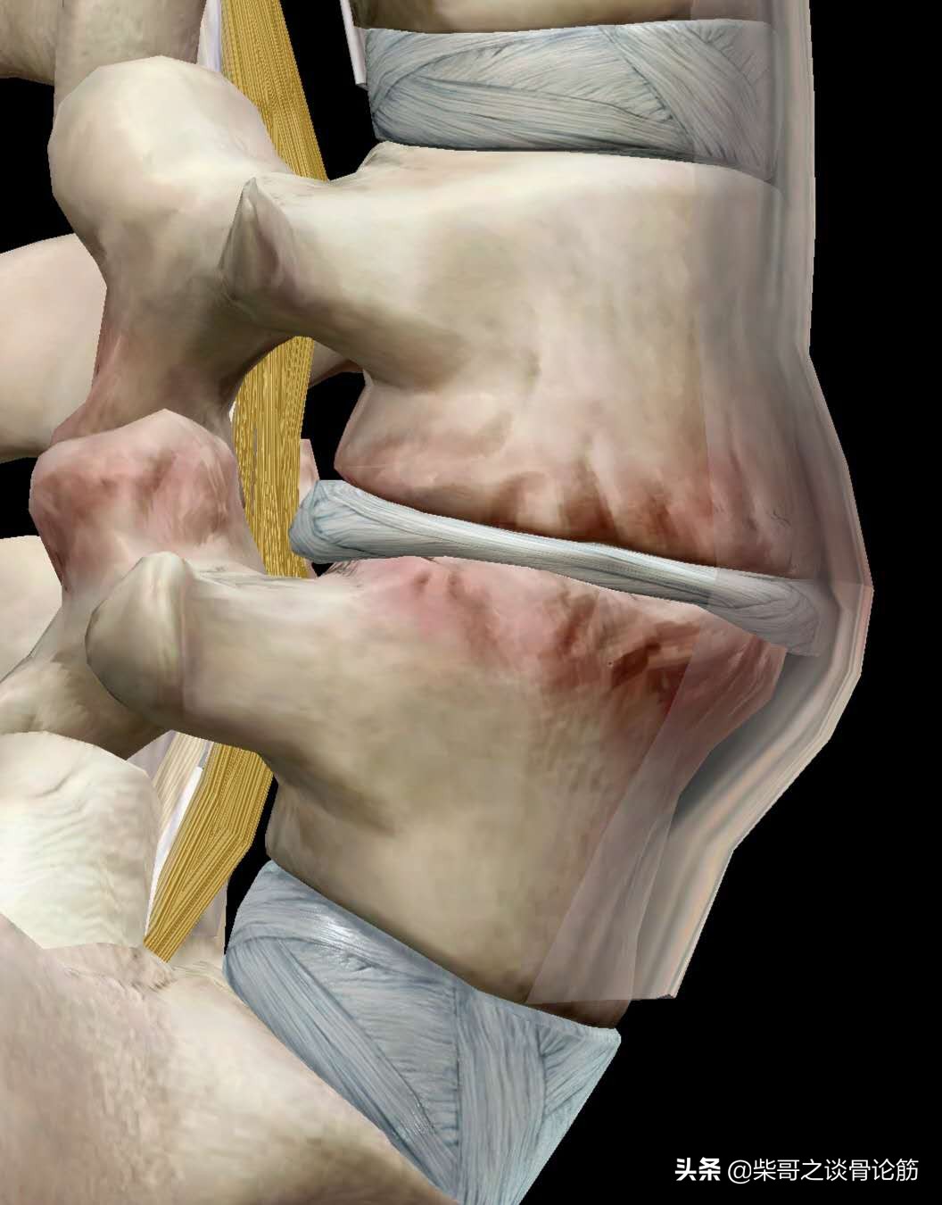 一般的腰椎间盘突出症有哪些,腰椎间盘突出有什么好的处理方法