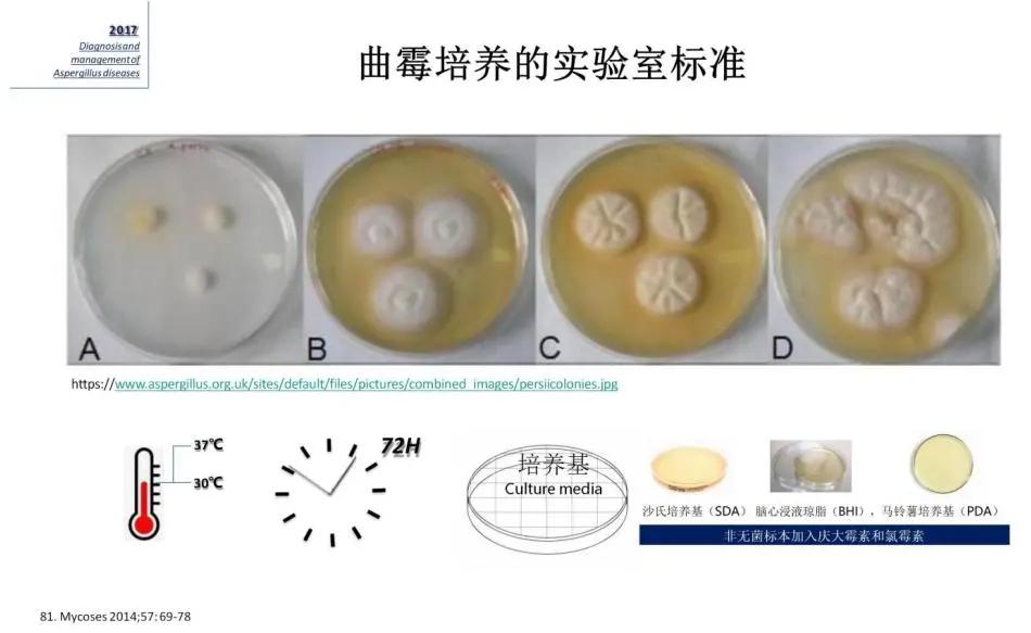 病原微生物检测是细菌培养吗,临床微生物检验与感染