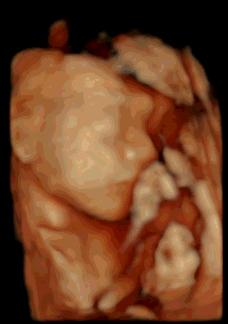 有没有在妇幼做四维彩超的,在妇幼保健院做四维彩超多少钱