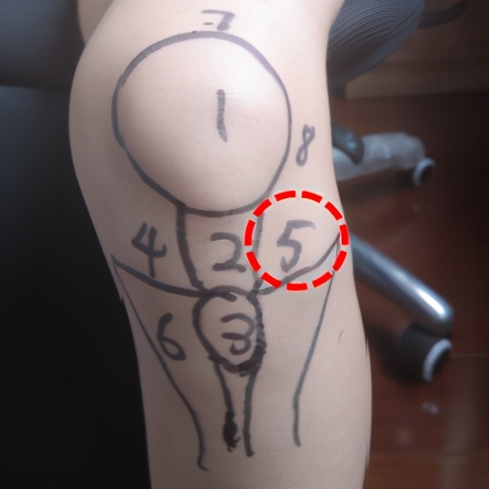 不同部位膝关节,骨科医生教你一招搞定膝盖痛