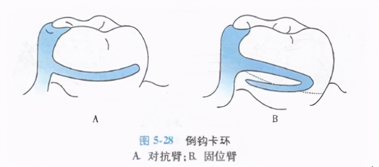 牙列缺损的可摘局部义齿修复题库,牙科美学修复精讲
