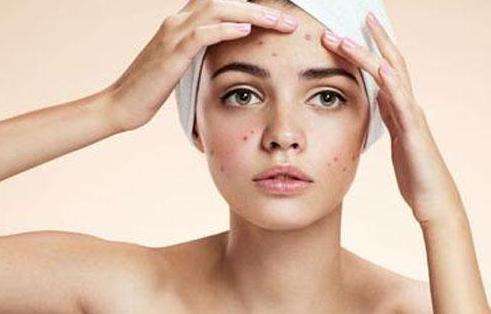 痘印怎么去除学生党,痘印怎么去除男生