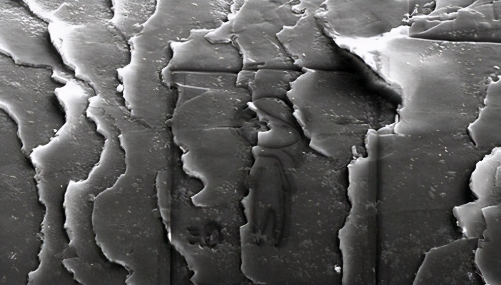 头发中段严重分叉断发是什么原因,头发特别细是什么原因