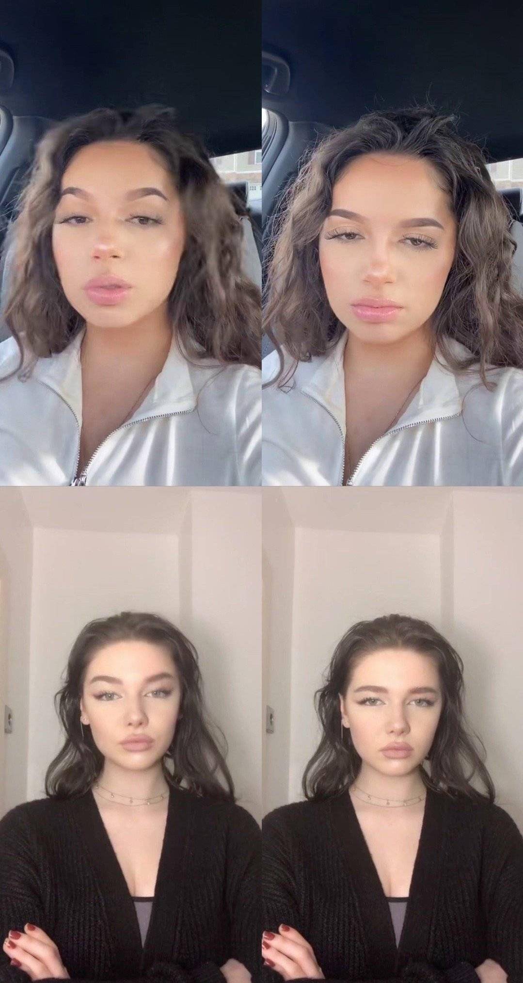 有没有不做手术就可以提眉,不做提眉还有什么方法抬高眉毛